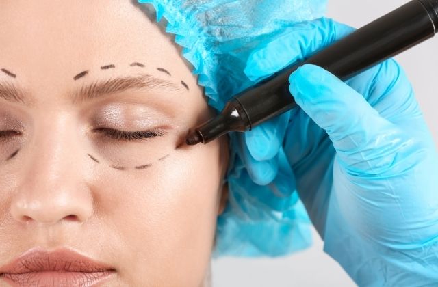 Czym jest blepharoplastyka i kto może z niej korzystać?